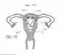Fig. 13 - INTRAUTERINE DEVICE
