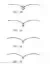 Fig. 24 - INTRAUTERINE DEVICE