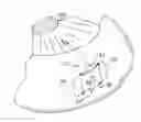Fig. 01 - Device and method for reducing intraocular pressure