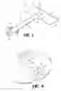 Fig. 02 - Device and method for reducing intraocular pressure