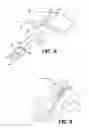 Fig. 06 - Device and method for reducing intraocular pressure