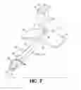 Fig. 07 - Device and method for reducing intraocular pressure