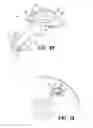 Fig. 09 - Device and method for reducing intraocular pressure