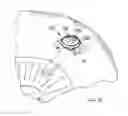 Fig. 11 - Apparatus and method for reducing intraocular pressure