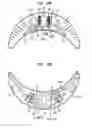 Fig. 20 - External ear canal pressure regulation system