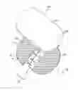 Fig. 01 - Apparatuses and methods for minimizing wound dehiscence, scar spread, and/or the like