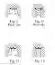 Fig. 09 - MENSTRUAL PANT