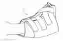 Fig. 01 - Heel protector and corresponding rehabilitation systems and methods for using the same