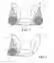 Fig. 05 - Heel protector and corresponding rehabilitation systems and methods for using the same