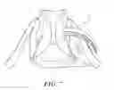 Fig. 06 - Heel protector and corresponding rehabilitation systems and methods for using the same