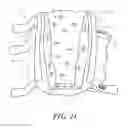 Fig. 09 - Heel protector and corresponding rehabilitation systems and methods for using the same