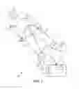 Fig. 02 - External peripheral vascular occlusion for enhanced cardiopulmonary resuscitation