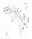 Fig. 10 - Systems and methods for head up cardiopulmonary resuscitation
