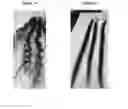 Fig. 02 - Hair-Straightening Compositions and Methods