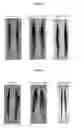 Fig. 03 - Hair-Straightening Compositions and Methods