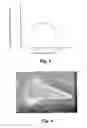 Fig. 05 - Coating method