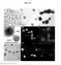 Fig. 20 - CLEAVABLE POLYMERIC MICELLES