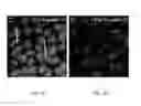 Fig. 09 - COMPOSITIONS AND METHODS FOR TREATING CARDIOVASCULAR AND PULMONARY DISEASES AND DISORDERS WITH APELIN