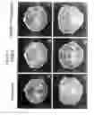 Fig. 04 - Methods of use for 2,5-dihydroxybenzene sulfonic acid compounds for the treatment of cancer