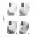 Fig. 08 - Methods of use for 2,5-dihydroxybenzene sulfonic acid compounds for the treatment of cancer