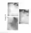 Fig. 11 - Methods of use for 2,5-dihydroxybenzene sulfonic acid compounds for the treatment of cancer