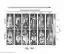 Fig. 19 - CDC7 kinase inhibitors and uses thereof