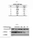 Fig. 03 - PHARMACEUTICAL COMPOSITION FOR PREVENTING OR TREATING OVARY GRANULOSA CELL TUMORS CONTAINING GLYCOGEN SYNTHASE KINASE-3 BETA INHIBITOR AS ACTIVE INGREDIENT, AND FUNCTIONAL HEALTH FOOD COMPOSITION