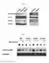 Fig. 04 - PHARMACEUTICAL COMPOSITION FOR PREVENTING OR TREATING OVARY GRANULOSA CELL TUMORS CONTAINING GLYCOGEN SYNTHASE KINASE-3 BETA INHIBITOR AS ACTIVE INGREDIENT, AND FUNCTIONAL HEALTH FOOD COMPOSITION