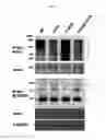 Fig. 07 - PHARMACEUTICAL COMPOSITION FOR PREVENTING OR TREATING OVARY GRANULOSA CELL TUMORS CONTAINING GLYCOGEN SYNTHASE KINASE-3 BETA INHIBITOR AS ACTIVE INGREDIENT, AND FUNCTIONAL HEALTH FOOD COMPOSITION