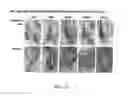 Fig. 40 - Methods for treating hair loss disorders