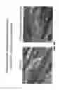 Fig. 66 - Methods for treating hair loss disorders