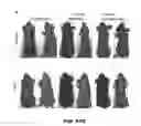 Fig. 80 - Methods for treating hair loss disorders