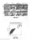 Fig. 82 - Methods for treating hair loss disorders