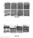 Fig. 95 - Methods for treating hair loss disorders