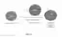 Fig. 10 - Methods for treating hair loss disorders