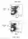 Fig. 24 - Methods for treating hair loss disorders