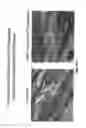 Fig. 65 - Methods for treating hair loss disorders