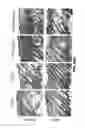 Fig. 77 - Methods for treating hair loss disorders