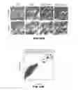 Fig. 81 - Methods for treating hair loss disorders
