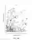 Fig. 87 - Methods for treating hair loss disorders