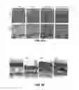 Fig. 94 - Methods for treating hair loss disorders