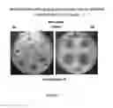 Fig. 06 - COMPOSITION AND FORMULATION OF ANTIMICROBIAL AGENTS, PROCESSES THEREOF AND METHODS FOR TREATING MICROBIAL INFECTIONS