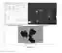 Fig. 10 - COMPOSITION AND FORMULATION OF ANTIMICROBIAL AGENTS, PROCESSES THEREOF AND METHODS FOR TREATING MICROBIAL INFECTIONS
