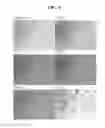 Fig. 10 - Composition for lipolysis, containing phosphatidylcholine, and preparation method therefor