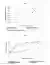 Fig. 07 - Formulations containing clopidogrel and sulfoalkyl ether cyclodextrin and methods of use