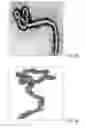 Fig. 04 - Therapy and Cure of Ebola