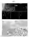 Fig. 04 - PHARMACEUTICAL COMPOSITION AND METHOD FOR REGENERATING MYOFIBERS IN THE TREATMENT OF MUSCLE INJURIES