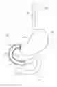 Fig. 01 - ADJUNCTS FOR GASTROINTESTINAL DEVICES
