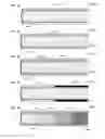 Fig. 15 - ADJUNCTS FOR GASTROINTESTINAL DEVICES