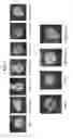 Fig. 11 - Methods and compositions for preventing or treating ophthalmic conditions